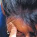 Incidenza dei disturbi neurologici raddoppiata nel Punjab: studio ICMR