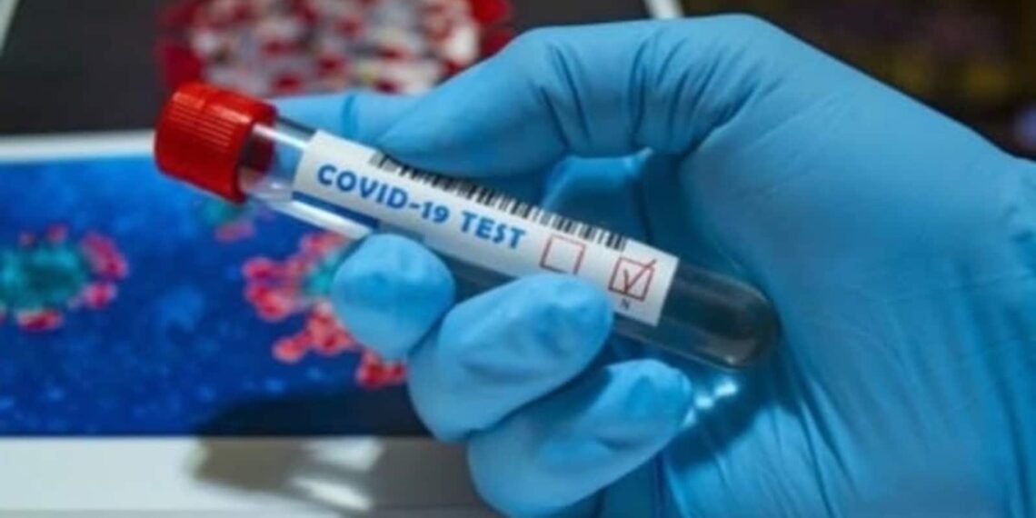 Coaguli di sangue nei casi gravi di Covid associati a una risposta anticorpale anormale: studio