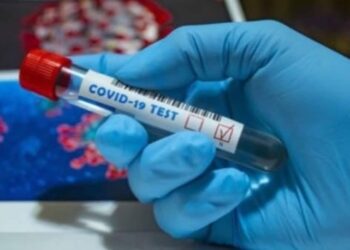 Coaguli di sangue nei casi gravi di Covid associati a una risposta anticorpale anormale: studio