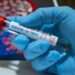Coaguli di sangue nei casi gravi di Covid associati a una risposta anticorpale anormale: studio