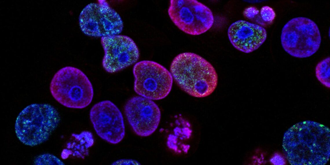 Lo studio dei tag del DNA può portare a una migliore comprensione degli esiti del trattamento del cancro