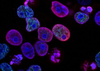 Lo studio dei tag del DNA può portare a una migliore comprensione degli esiti del trattamento del cancro