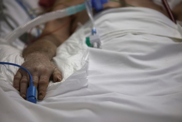 La Gran Bretagna chiede un'azione contro il pregiudizio razziale nei dispositivi medici