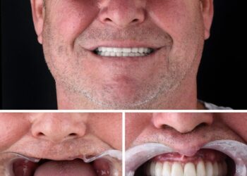 Miglior dentista a Tirana: Marco Memoli e il progetto Good Smile Italy che rivoluziona il turismo dentale etico