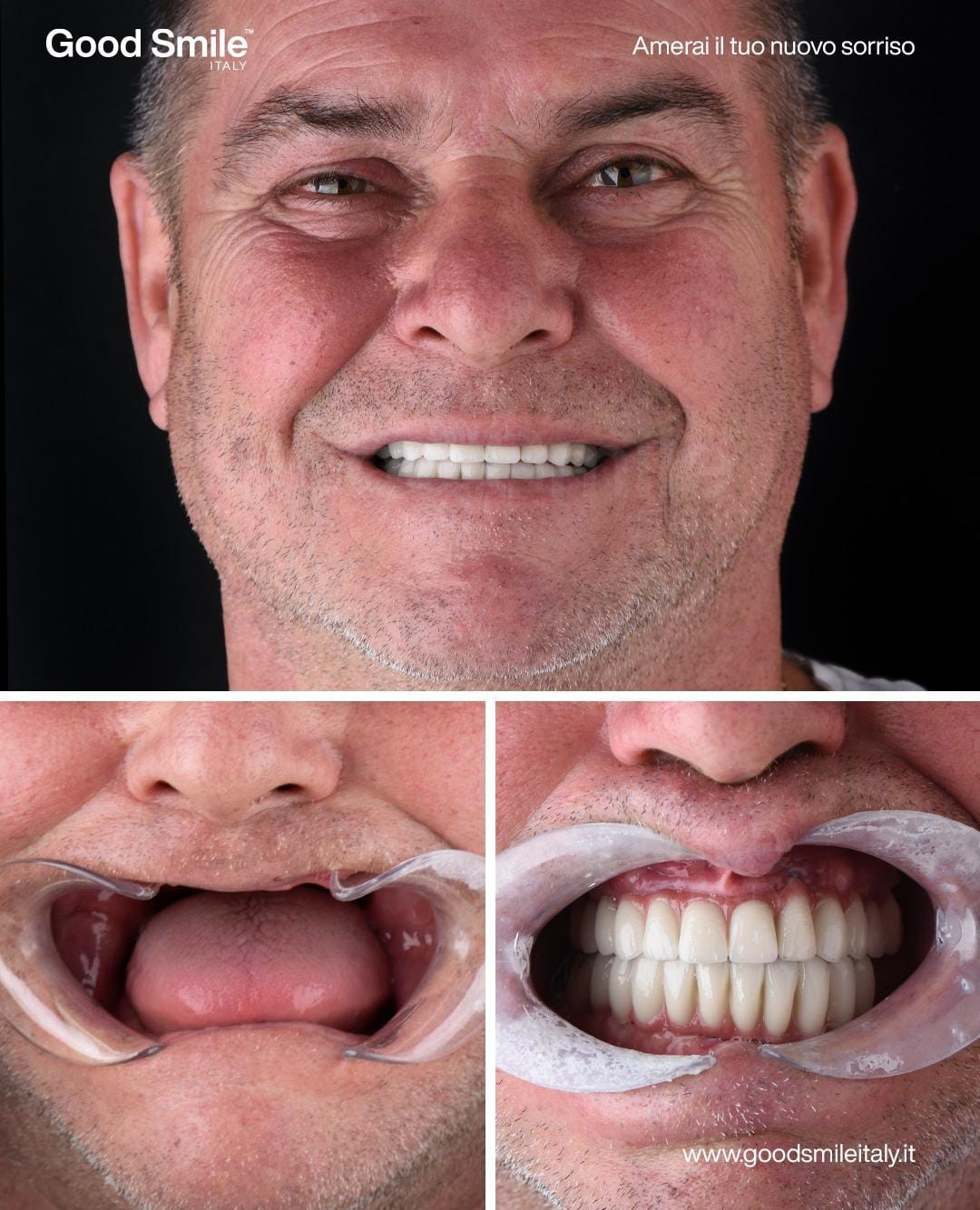 Miglior dentista a Tirana: Marco Memoli e il progetto Good Smile Italy che rivoluziona il turismo dentale etico